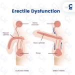 What Prescription Drugs May Cause Erectile Dysfunction?